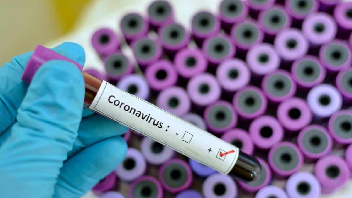 Cingapura vai distribuir “rastreador de Coronavírus”