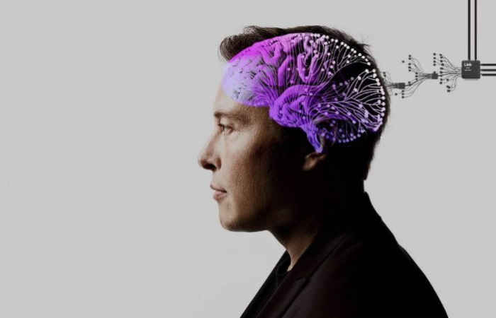 Neuralink obtém aprovação para estudo de implantes cerebrais em humanos